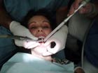 Patients are mainly exposed when fillings are placed or
							removed