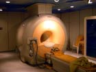 MRI scanners use static magnetic fields
